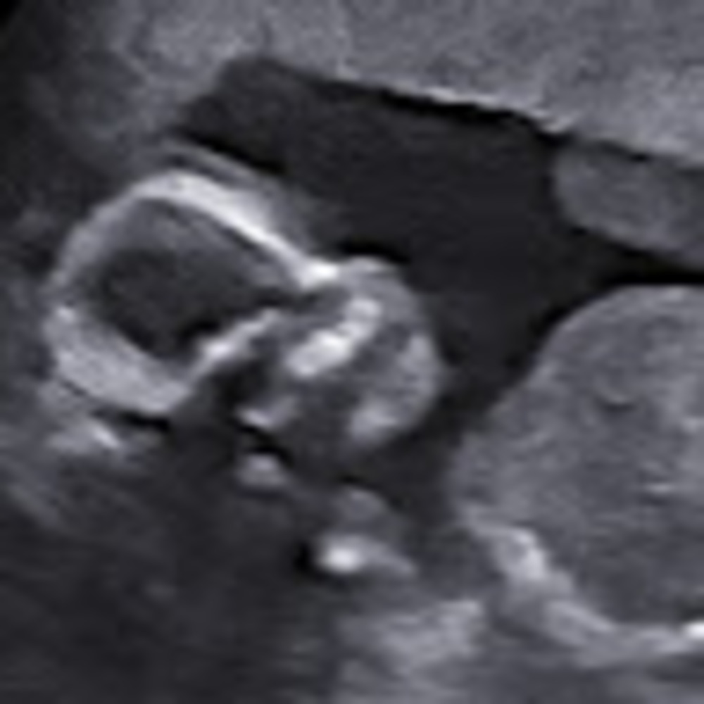 Meet your Posher, Luke